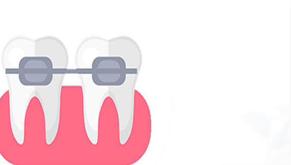Braces / Orthodontic Treatment